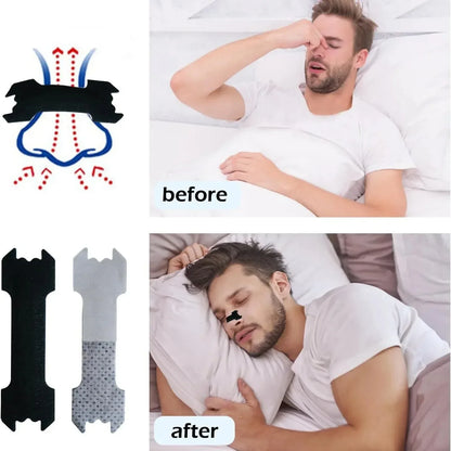 Capilorix anti snoring nose patch set with extra strength nasal strips for better breathing and easier sleep, 30/90/150 pieces.